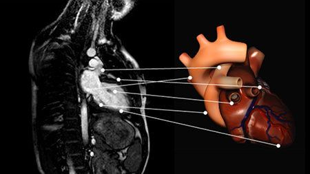 Система визуализации магниторезонансных томограмм (МРТ) сердца человека