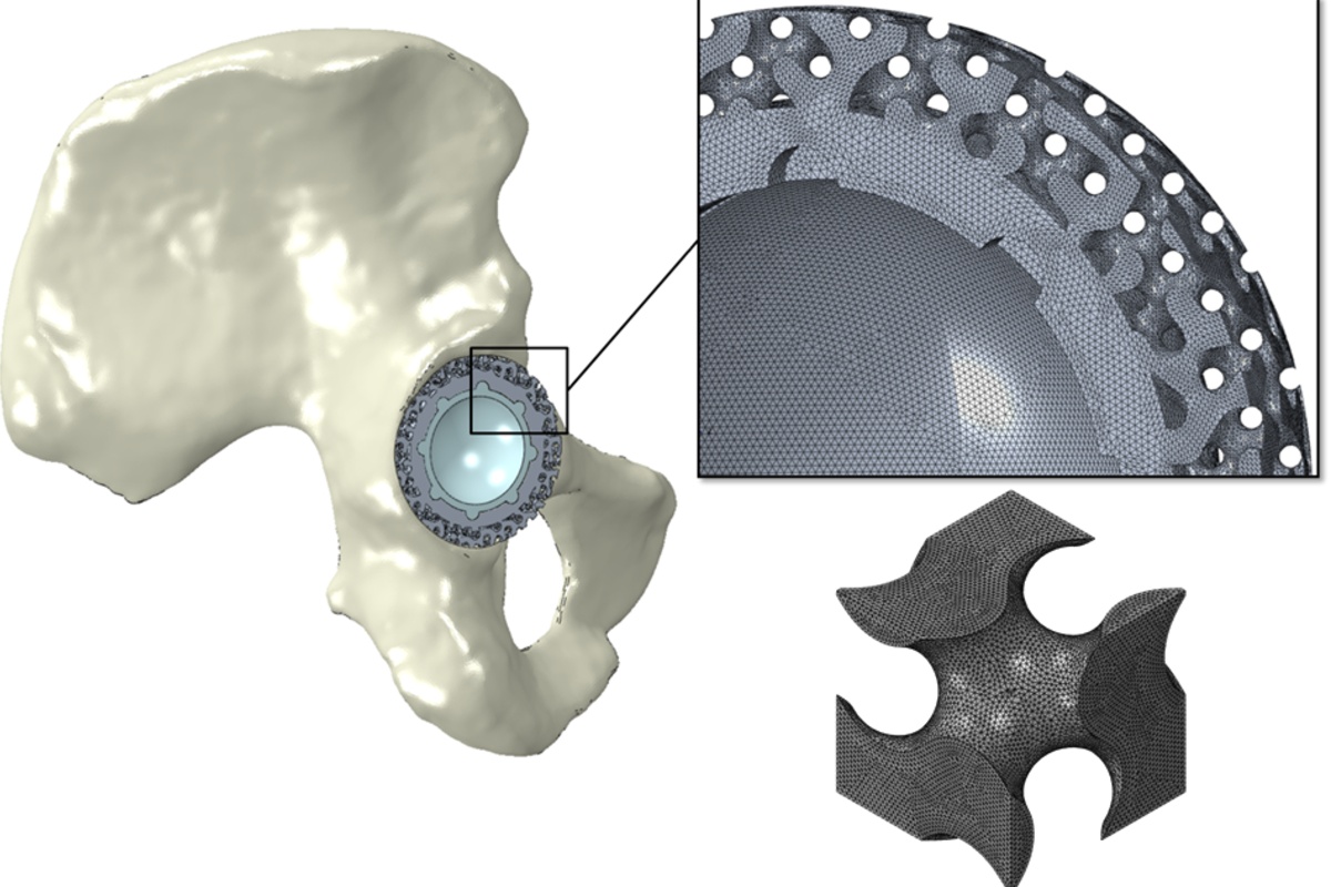 Протез представляет собой сложный 3D-лабиринт с микроструктурой 