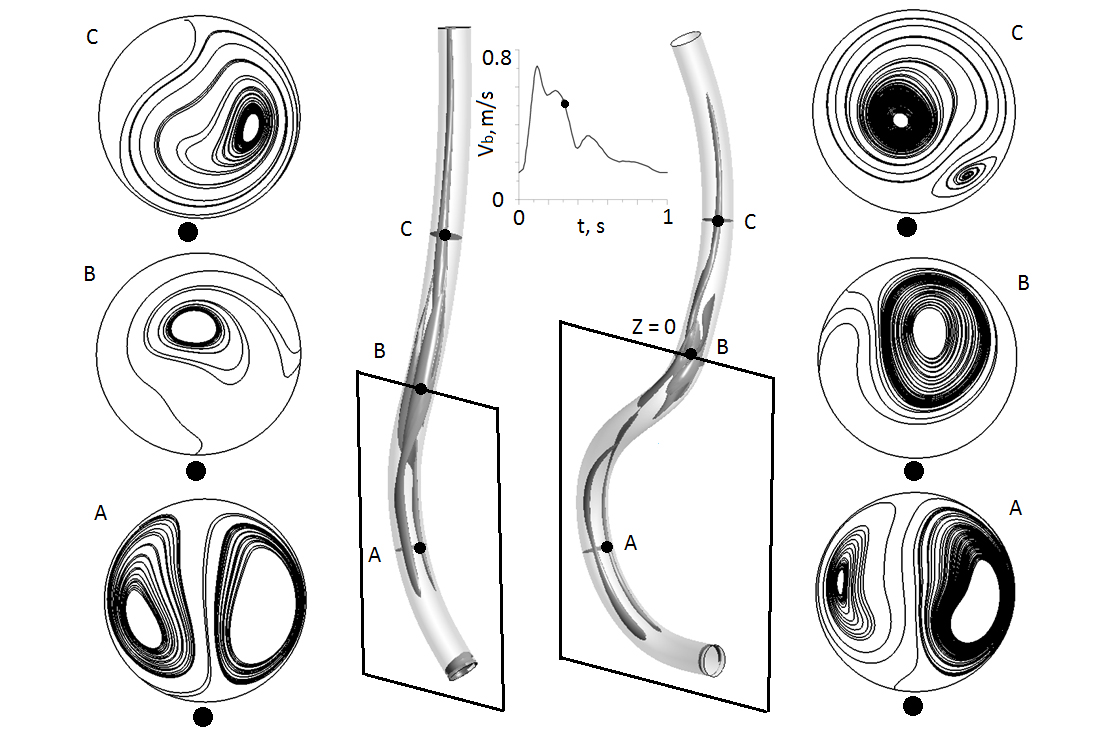 Тема: Расчетно-экспериментальное исследование закрученных течений в моделях кровеносных сосудов